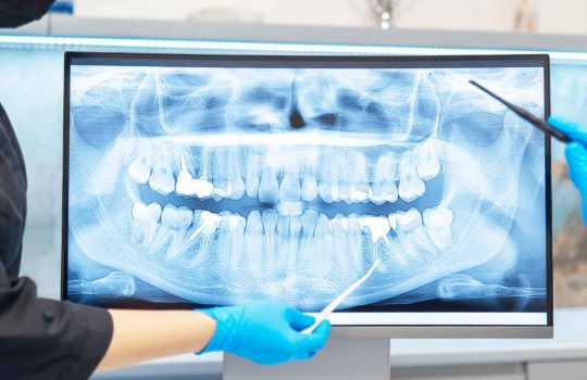 Mobile Dental CT Scans2